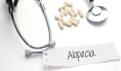 Alopecia Areata