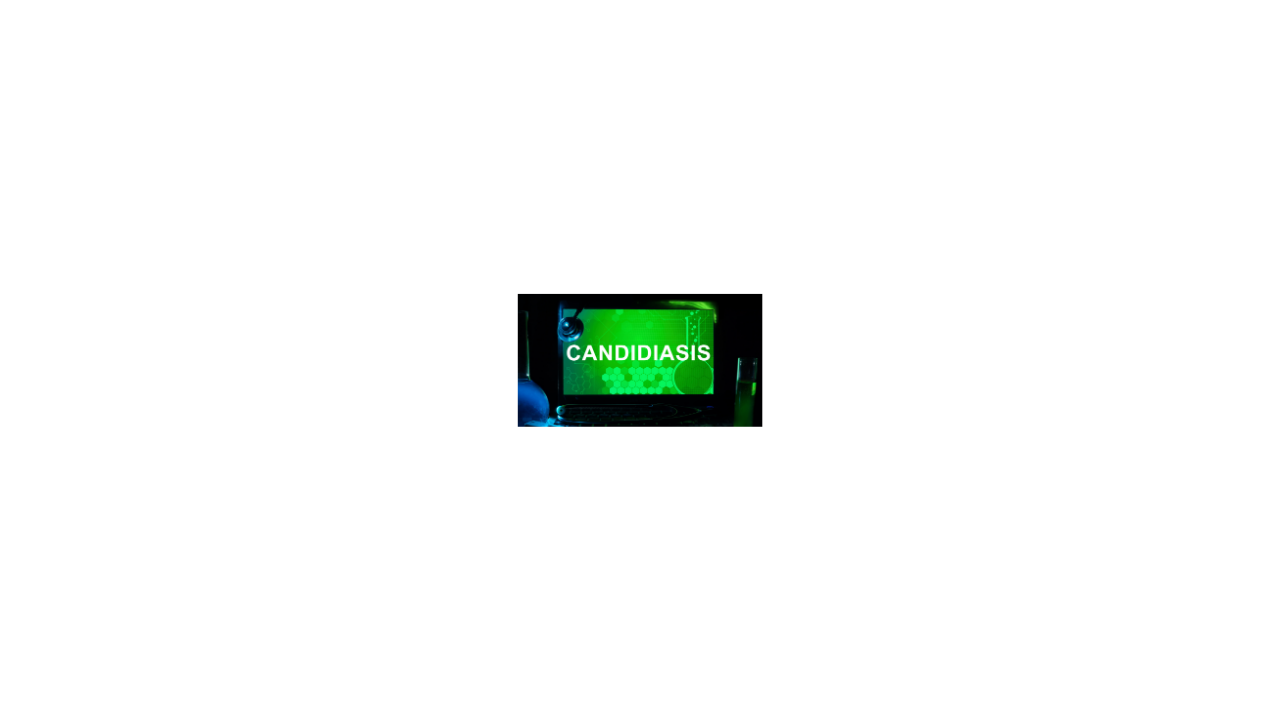 Candidiasis