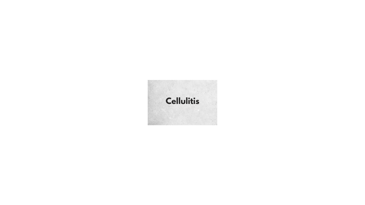Cellulitis