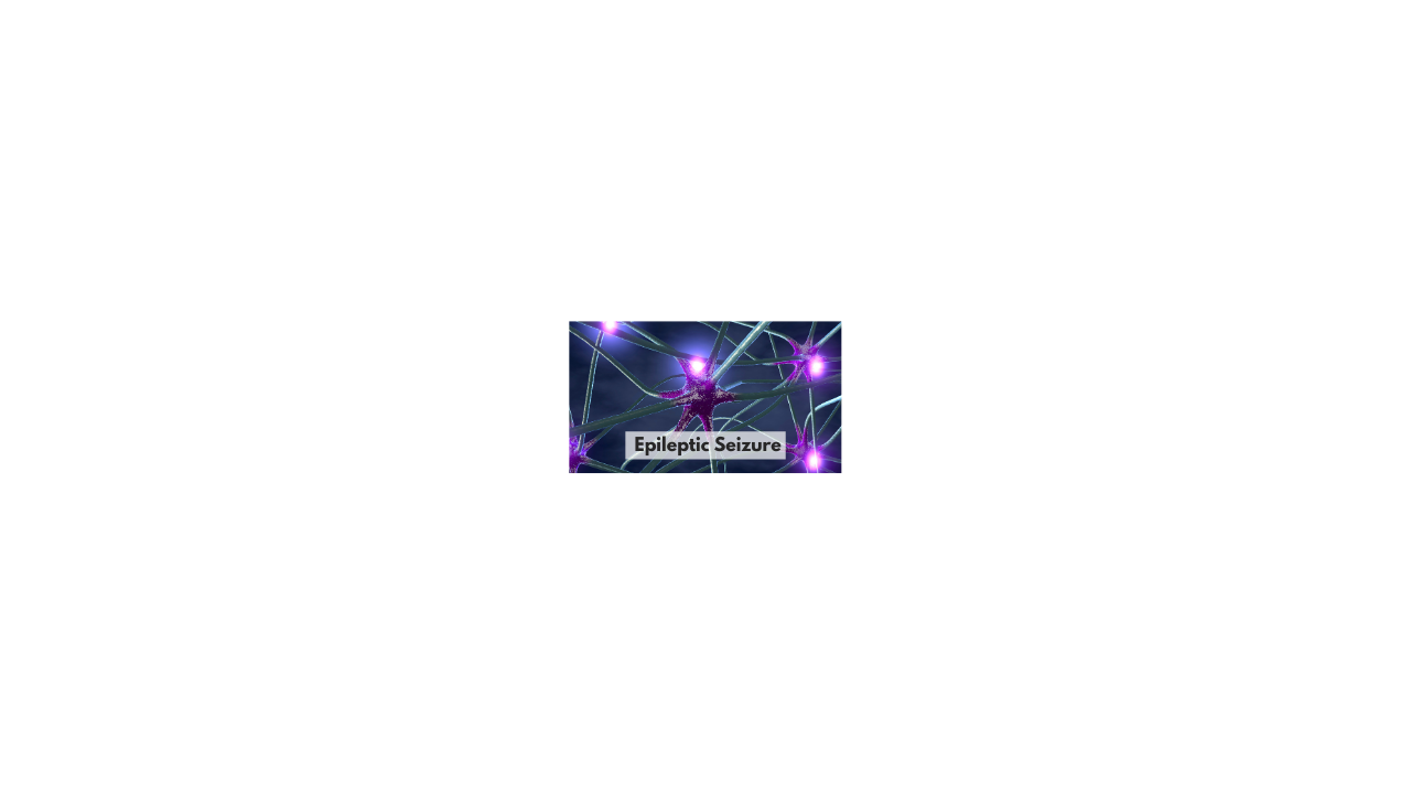 Epileptic seizure