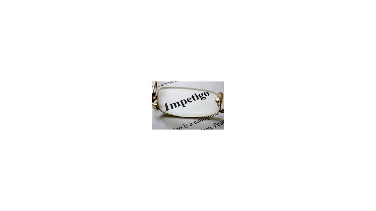 Impetigo