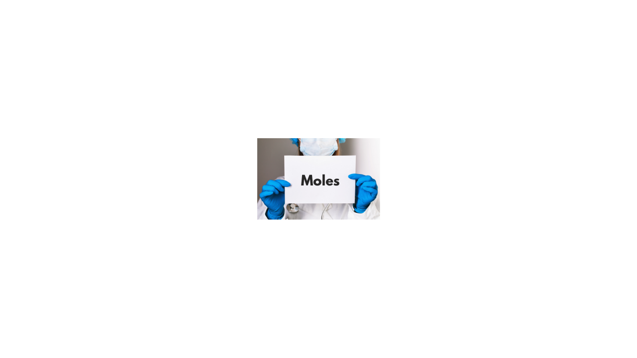 Moles