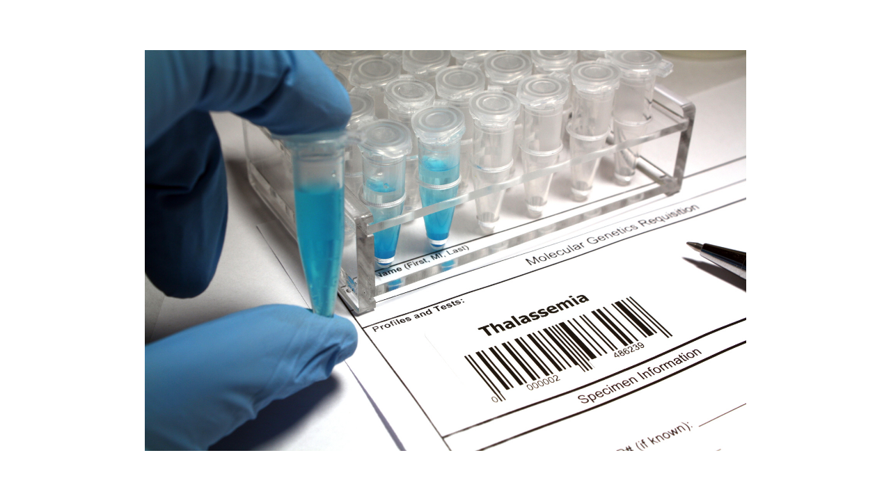 What is Thalassemia